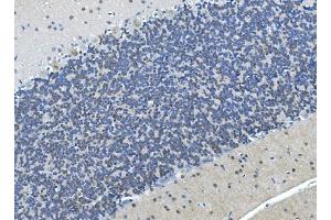 IHC analysis of LSM7 using anti-LSM7 antibody (ABIN7598937).