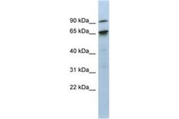 CTIF/KIAA0427 antibody  (AA 71-120)
