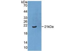 Figure. (XPO1 Antikörper  (AA 917-1071))