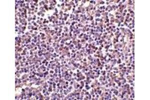 Immunohistochemistry (IHC) image for anti-AIM (N-Term) antibody (ABIN1031223) (AIM (N-Term) Antikörper)