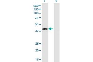 Western Blot analysis of SPG11 expression in transfected 293T cell line by SPG11 MaxPab polyclonal antibody. (SPG11 Antikörper  (AA 1-425))