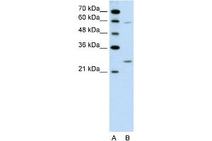 WB Suggested Anti-GAMT Antibody Titration:  0.