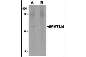 Western blot analysis of MATN4 in rat brain tissue lysate with this product at 1 μg/ml in (A) the absence and (B) the presence of blocking peptide. (MATN4 Antikörper  (N-Term))