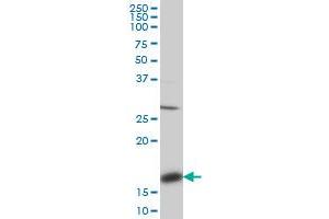 Western Blotting (WB) image for anti-Acid Phosphatase 1, Soluble (ACP1) (AA 1-158) antibody (ABIN559750)