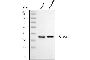 Western blot analysis of SFXN5 using anti-SFXN5 antibody (ABIN7601388). (Sideroflexin 5 Antikörper  (AA 34-340))