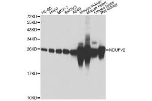 Western blot analysis of extracts of various cell lines, using NDUFV2 antibody (ABIN4904507) at 1:1000 dilution. (NDUFV2 Antikörper)