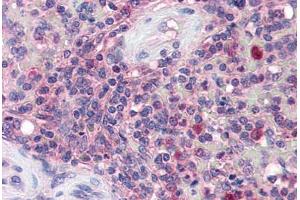 Human Spleen (formalin-fixed, paraffin-embedded) stained with KPNB1 antibody ABIN337256 at 5 ug/ml followed by biotinylated anti-goat IgG secondary antibody ABIN481715, alkaline phosphatase-streptavidin and chromogen. (KPNB1 Antikörper  (AA 851-863))
