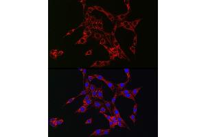 Immunofluorescence analysis of PC-12 cells using HB-EGF Rabbit pAb (ABIN6130449, ABIN6141644, ABIN6141645 and ABIN6218793) at dilution of 1:150 (40x lens). (HBEGF Antikörper  (AA 20-160))