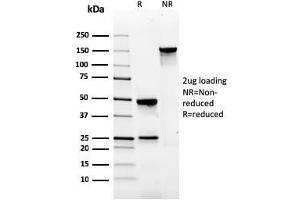 SDS-PAGE Analysis Purified Gastrin Mouse Monoclonal Antibody (GAST/2634). (Gastrin Antikörper)