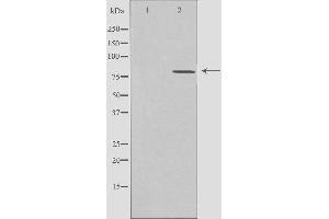 Western blot analysis of extracts from MCF-7 cells, using CLCN4 antibody.