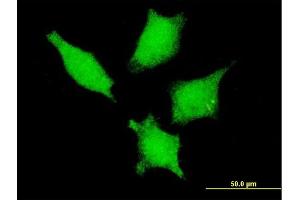 Immunofluorescence of monoclonal antibody to DDX20 on HeLa cell. (DDX20 Antikörper  (AA 725-824))