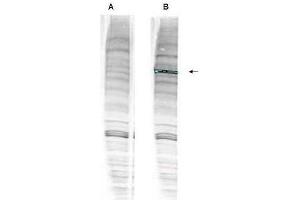 Western blot analysis is shown using  anti-Human WHIP antibody with and without pre-incubation with blocking peptide. (WRNIP1 Antikörper  (Internal Region, Isoform 1, Isoform 2))