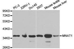 Western Blotting (WB) image for anti-Menage A Trois Homolog 1, Cyclin H Assembly Factor (Xenopus Laevis) (MNAT1) antibody (ABIN1873734) (MNAT1 Antikörper)
