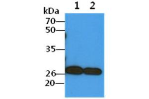 The Cell lysates (40ug) were resolved by SDS-PAGE, transferred to PVDF membrane and probed with anti-human COMMD7 antibody (1:1000). (COMMD7 Antikörper)