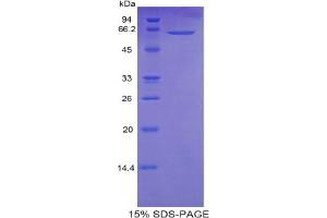 SDS-PAGE analysis of Human Calmodulin 1 Protein. (Calmodulin 1 Protein (Calm1))