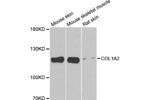 Western blot analysis of extracts of various cell lines, using COL1A2 antibody. (COL1A2 Antikörper)