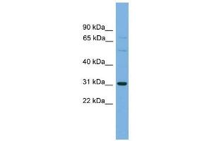 Western Blot showing SLCO1B1 antibody used at a concentration of 1-2 ug/ml to detect its target protein.