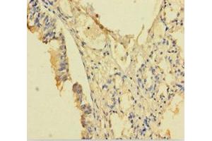 Immunohistochemistry of paraffin-embedded human lung tissue using ABIN7168126 at dilution of 1:100 (RPP29 Antikörper  (AA 1-220))