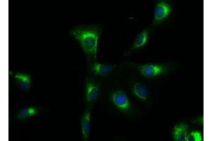 Immunofluorescent staining of A549 cells using anti-SOX17 mouse monoclonal antibody (ABIN2452377).