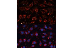 Immunofluorescence analysis of C6 cells using CASP3 antibody. (Caspase 3 Antikörper  (AA 55-160))