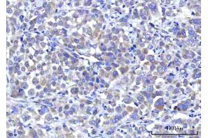 IHC analysis of RPS5 using anti-RPS5 antibody (ABIN7599076). (RPS5 Antikörper  (AA 1-204))
