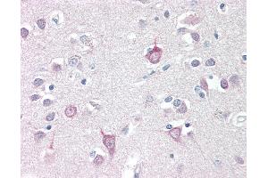 Anti-AP3B2 antibody IHC staining of human brain, cortex. (AP3B2 Antikörper  (N-Term))