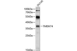 Western blot analysis of extracts of DU145 cells, using TMEM74 antibody (ABIN6131065, ABIN6149271, ABIN6149272 and ABIN6214614) at 1:1000 dilution. (TMEM74 Antikörper  (AA 1-180))