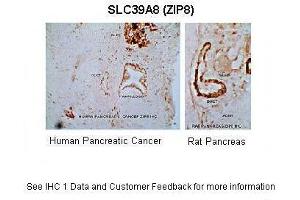 Sample Type :  Human Pancreas (Cancer) & rat pancreas   Primary Antibody Dilution :  1:150  Secondary Antibody :  Goat anti-Rabbit  Secondary Antibody Dilution :  1:300  Gene Name :  SLC39A8  Submitted by :  Anonymous (SLC39A8 Antikörper  (N-Term))