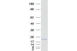 VOPP1 Protein (Myc-DYKDDDDK Tag)