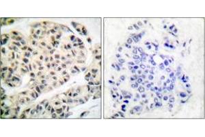 Immunohistochemistry (IHC) image for anti-Myocyte Enhancer Factor 2A (MEF2A) (pThr319) antibody (ABIN2888467) (MEF2A Antikörper  (pThr319))
