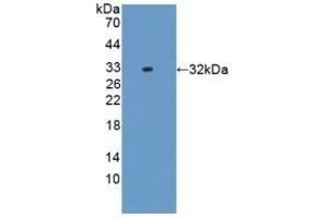 Detection of Recombinant IL17RD, Rat using Polyclonal Antibody to Interleukin 17 Receptor D (IL17RD) (IL17RD Antikörper  (AA 356-605))