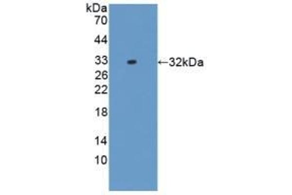 IL17RD Antikörper  (AA 356-605)