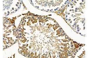 ABIN6263769 and ABIN6277767 at 1/100 staining Rat testis tissue by IHC-P. (NUMB Antikörper  (C-Term))