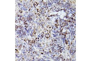 Immunohistochemistry of paraffin-embedded rat spleen using THBS1 Rabbit pAb (ABIN3022978, ABIN3022979, ABIN3022980 and ABIN6219329) at dilution of 1:50 (40x lens). (Thrombospondin 1 Antikörper  (AA 80-360))