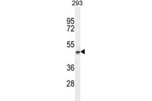 Western Blotting (WB) image for anti-Cochlin (COCH) antibody (ABIN2996145) (COCH Antikörper)