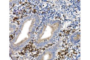 anti-CD38 (C-Term) antibody