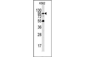 Image no. 1 for anti-Phosphoinositide-3-Kinase, Regulatory Subunit 5 (PIK3R5) (Middle Region) antibody (ABIN360464) (PIK3R5 Antikörper  (Middle Region))