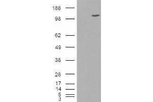 ESYT1 Antikörper  (Internal Region)