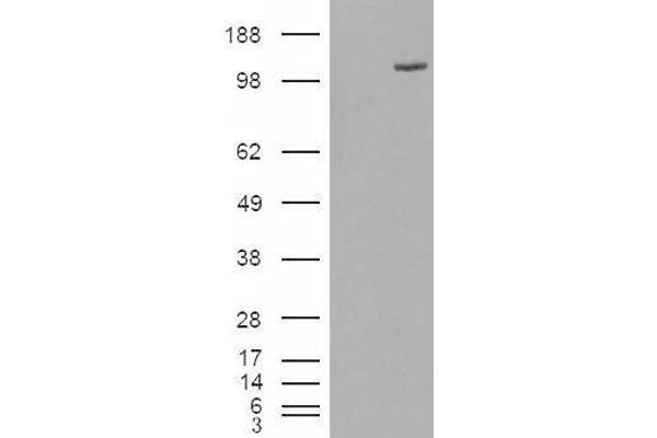 ESYT1 Antikörper  (Internal Region)