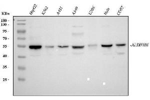 Western blot analysis of ALDH1B1 using anti-ALDH1B1 antibody (ABIN4886450).