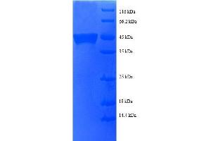 SDS-PAGE (SDS) image for Basic Transcription Factor 3 (BTF3) (AA 48-206), (partial) protein (GST tag) (ABIN1047753)