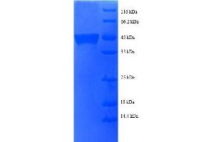 Basic Transcription Factor 3 (BTF3) (AA 48-206), (partial) protein (GST tag) (BTF3 Protein (AA 48-206, partial) (GST tag))