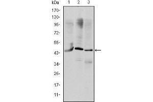 Western blot analysis using OTX2 mouse mAb against HepG2 (1), Jurkat (2), and NTERA-2 (3) cell lysate. (OTX2 Antikörper)