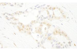 Immunohistochemistry (IHC) image for anti-Serine/threonine-Protein Kinase PRP4 Homolog (PRPF4B) (AA 1-50) antibody (ABIN7448746) (PRPF4B Antikörper  (AA 1-50))