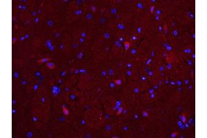 Paraformaldehyde-fixed, paraffin embedded Mouse brain; Antigen retrieval by boiling in sodium citrate buffer (pH6. (MUL1 Antikörper  (AA 45-95))