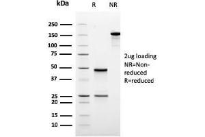 SDS-PAGE Analysis Purified ODC-1 Recombinant Mouse Monoclonal Antibody (rODC1/485). (Rekombinanter ODC1 Antikörper)