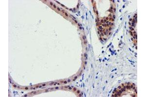 Immunohistochemical staining of paraffin-embedded Human breast tissue using anti-FBXO21 mouse monoclonal antibody. (FBXO21 Antikörper)