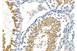 ABIN6262069 and ABIN6276964 at 1/100 staining Rat testis tissue by IHC-P. (GPX4 Antikörper  (C-Term))