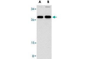 Western blot analysis of PPPDE1 in EL4 cell lysate with PPPDE1 polyclonal antibody  at (A) 1 and (B) 2 ug/mL . (PPPDE1 Antikörper  (C-Term))