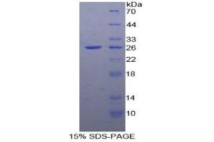 SDS-PAGE analysis of Human FADD Protein. (FADD Protein)